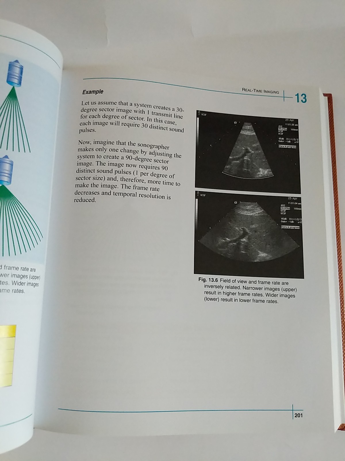 Understanding Ultrasound Physics Edelman 3rd Edition Sonography Book